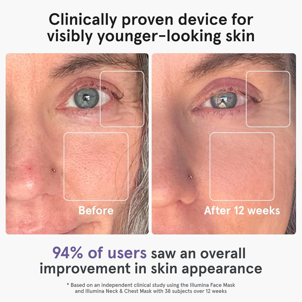 iRestore LED Face Mask for Youthful Skin