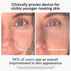 iRestore LED Face Mask for Youthful Skin